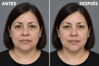 Kit Antiaging